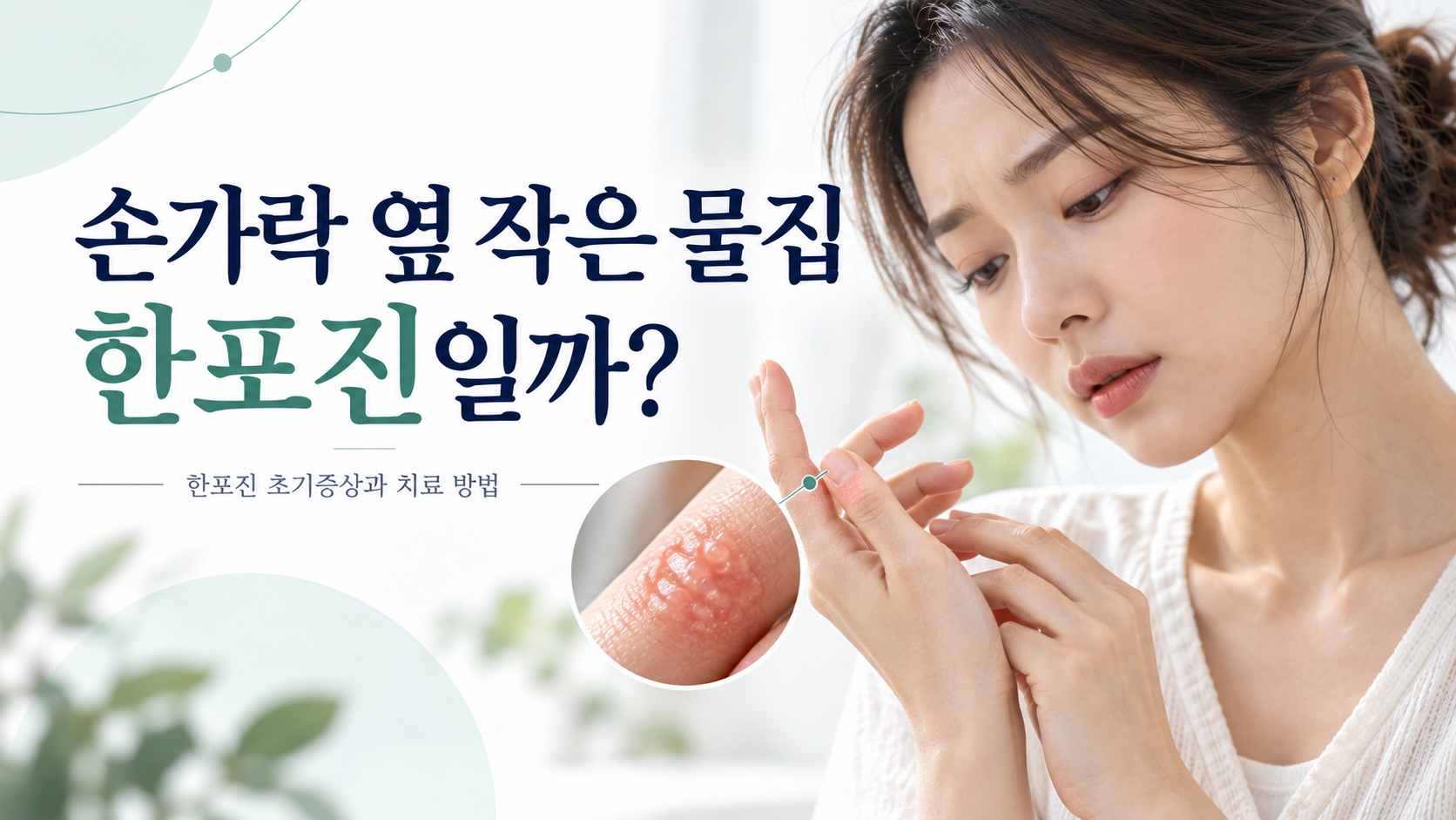 손가락 옆 작은 물집 한포진일까